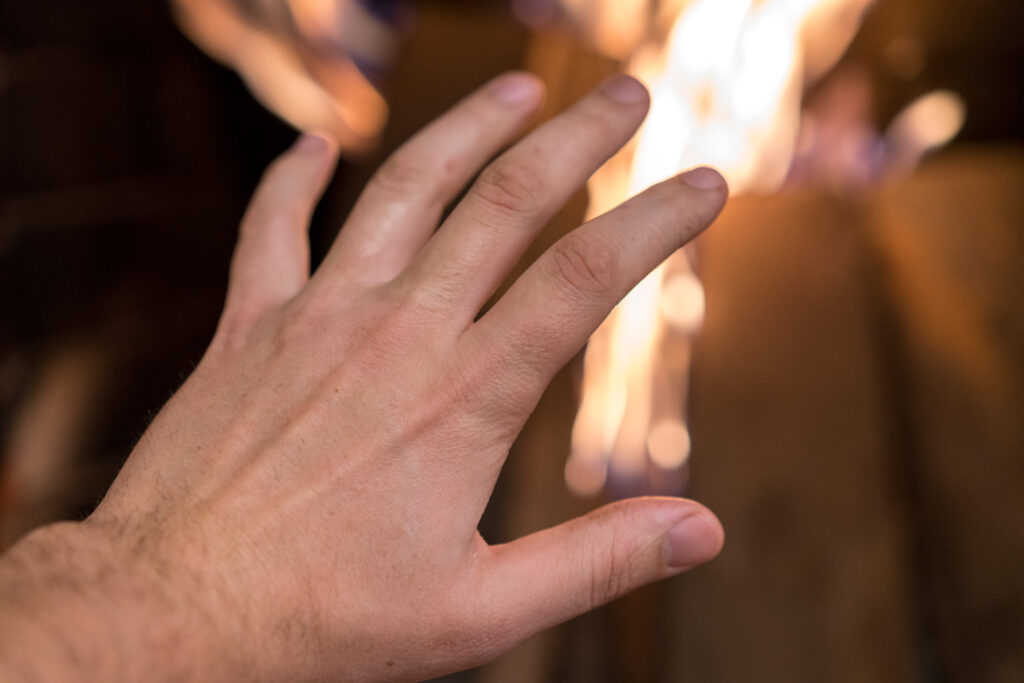 Peoria Burn Injuries Lawyer