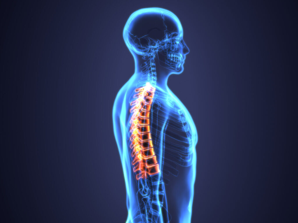 Abogados de lesiones de la columna vertebral en Seattle 