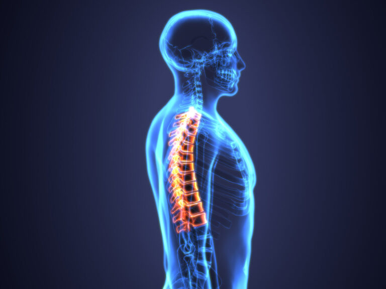 Abogados de lesiones de la columna vertebral en El Paso