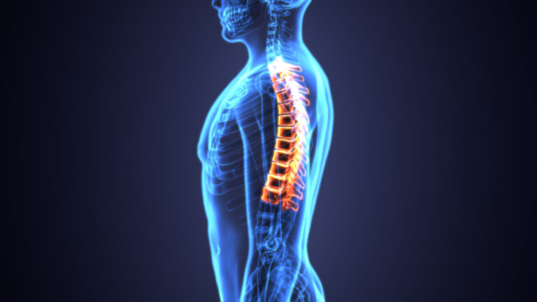 Portland Spinal Injury Attorney