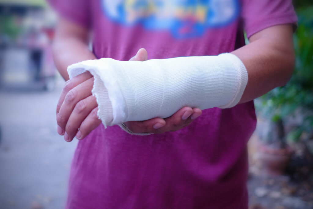 Costa Mesa Bone Fractures Lawyer