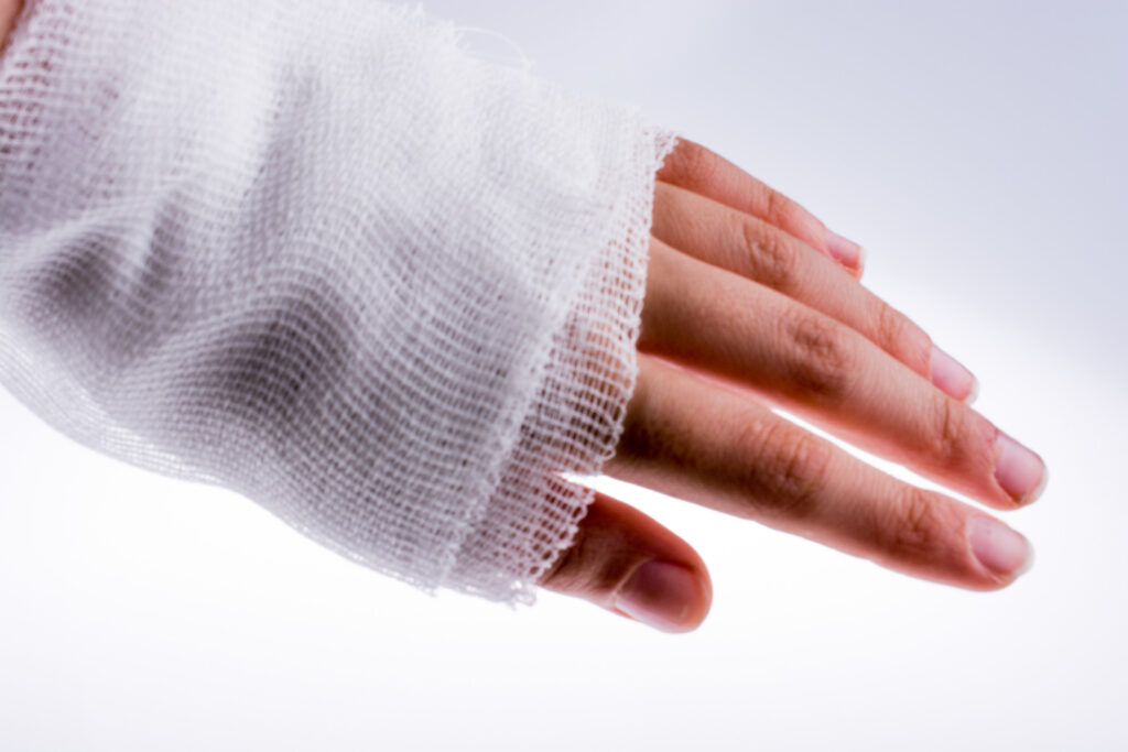 Fullerton Burn Injuries Lawyer