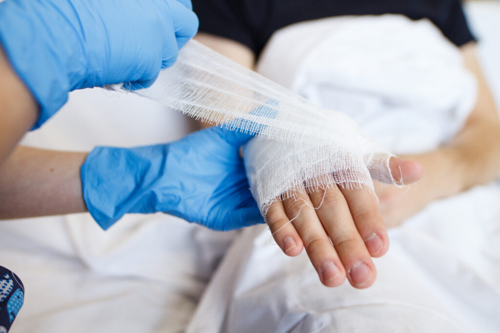 Garden Grove Burn Injuries Lawyer