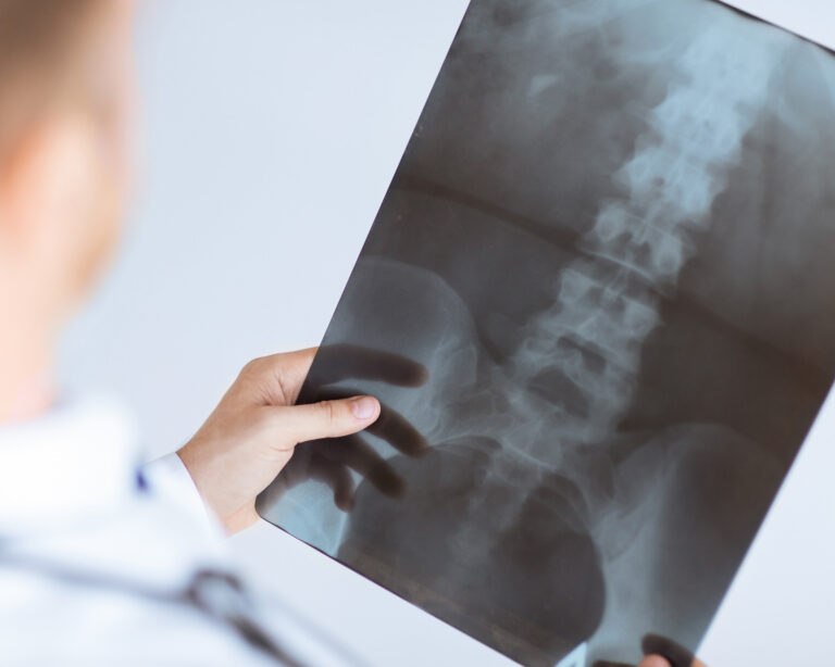 Peoria, Arizona, spinal injury lawyer