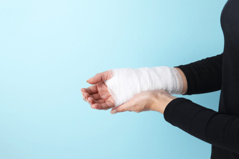 Redmond Burn Injuries Lawyer