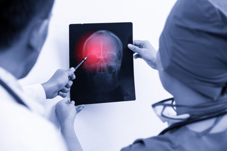 Goodyear Brain Injury Lawyer
