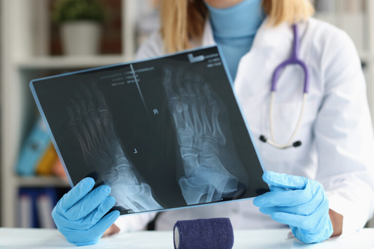 Pasadena Bone Fractures Lawyer