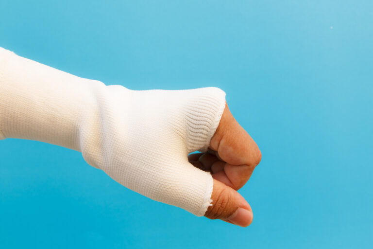 Riverside Burn Injuries Lawyer