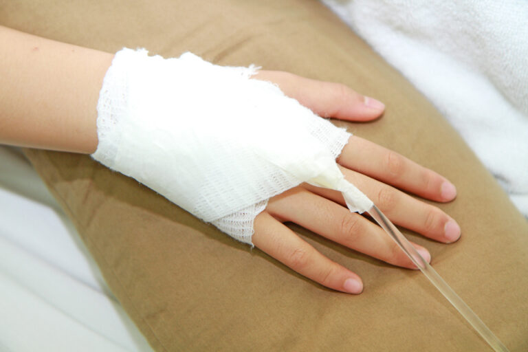 Rancho Cucamonga Burn Injuries Lawyer